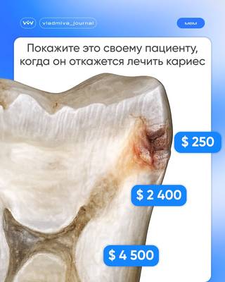 Профилактика — лучшая экономия. Вовремя к стоматологу!